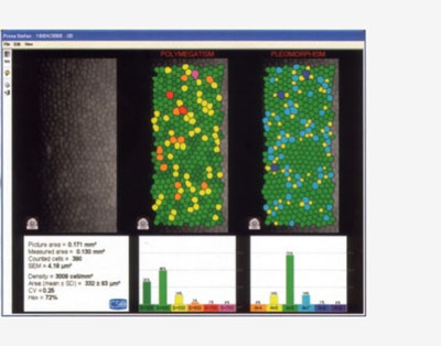 microscopia_2