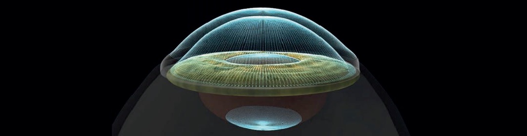 femtocataratta-02