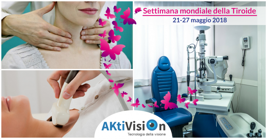 Oftalmopatia tiroidea, esoftalmo e ipertiroidismo - Aktivision Blog